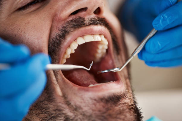 Emergency Dental Services in Walton Hills, OH
